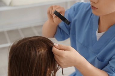 Büyüteci olan kadın doktor klinikte pediküloz için küçük kızın kafasını kontrol ediyor.