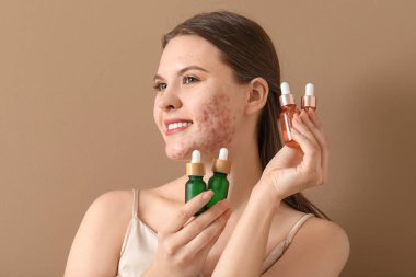 Sivilceli genç bir kadın ve kahverengi arka planda bir şişe serum, yakın plan.