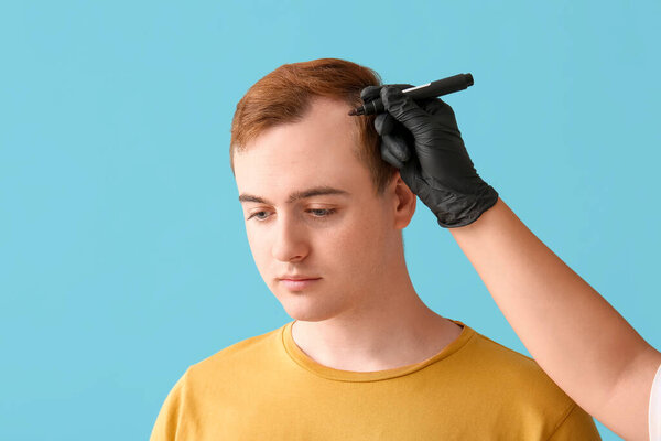 Трихолог маркирует лоб молодого человека проблемой выпадения волос на синем фоне, крупным планом