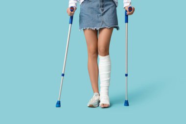 Mavi arka planda koltuk değnekleri ve kırık bacağı olan genç bir kadın.