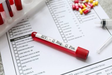HIV testi tüpü, laboratuvar raporu formu ve gri grunge arka planda haplar.