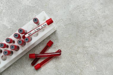Gri grunge arka planda HIV kan testi tüpleri