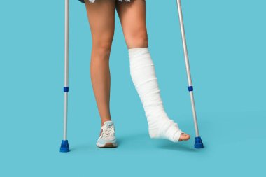 Mavi arka planda koltuk değnekleri ve kırık bacağı olan genç bir kadın.