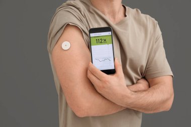 Glikoz sensörü olan diyabetik genç adam kan şekerini koyu arkaplanda ölçmek için cep telefonu kullanıyor.