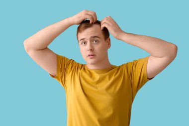 Mavi arka planda saç kaybı sorunu olan endişeli kızıl saçlı genç bir adam.