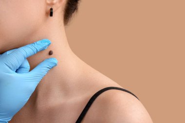 Dermatolog bej arka plandaki hastanın mol 'lerini inceliyor.