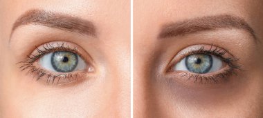 Genç bayanın göz altı koyu halkalı ya da değil, yakın çekim.