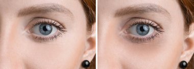 Genç bayanın göz altı koyu halkalı ya da değil, yakın çekim.