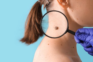 Cildiyecisi elinde büyüteçle kadının boynundaki benleri mavi arka planda inceleyen, yakın plan.