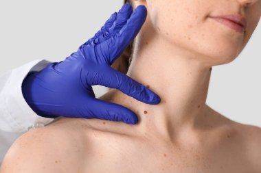 Dermatolog klinikte kadının boynundaki beni inceliyor.