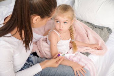 Anne, yatak odasında suçiçeği yüzünden kızına termometre veriyor.