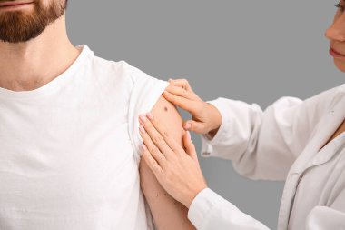 Cildiyeci, gri arka plandaki erkek hastaların benlerini inceliyor. Yakın çekim.
