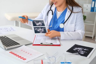 Ofiste masasında ultrason görüntüsü olan kadın jinekolog, yakın plan.