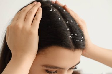 Beyaz arka planda kepek sorunu olan genç bir kadın, yakın plan.