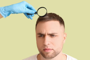 Doktor yeşil arka planda saç kaybı sorunu olan adamı yakından muayene ediyor.