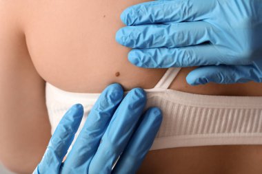 Dermatolog kadının vücudunda beni inceliyor.