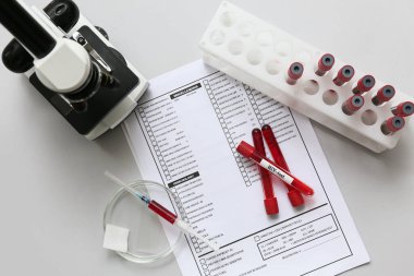 HIV kan testi tüpleri, mikroskop ve gri arka planda laboratuvar raporu
