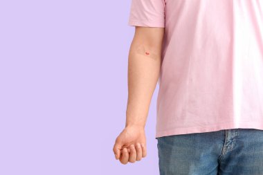 Blood donor with applied medical patch on lilac background, closeup