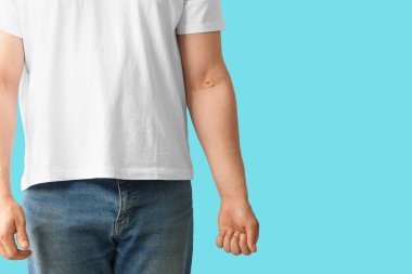 Blood donor with applied medical patch on blue background