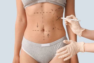 Plastik cerrah arka planda kadının karnını işaretliyor, yakın plan.