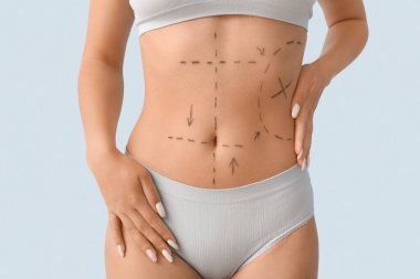 İç çamaşırlı genç bir kadın, karnında hafif arka planda izler var, yakın plan. Estetik ameliyat konsepti