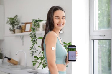 Glikoz sensörü ve cep telefonu olan şeker hastası genç bir kadın mutfakta kan şekeri seviyesini ölçüyor.