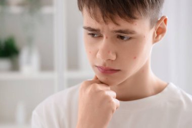 Banyoda sivilceli düşünceli genç çocuk, yakın plan.