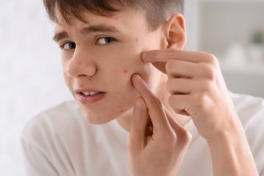 Sivilceli ergen çocuk banyoda, yakın plan.