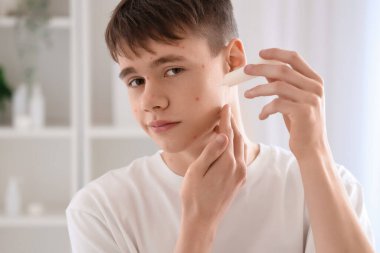 Sivilceli genç banyoda krem sürüyor, yakın plan.