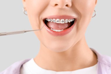 Diş telleri ve arka planda gülümseyen aletli genç kadın, yakın plan.