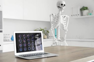 Masada insan iskeleti modeli ve modern dizüstü bilgisayarı olan hafif bir hastane.