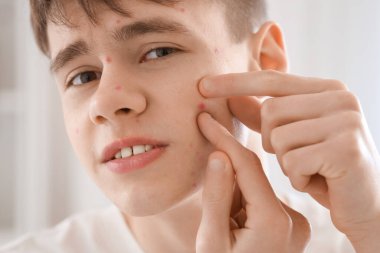 Sivilceli ergen çocuk banyoda, yakın plan.