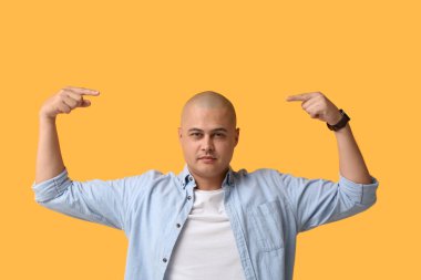 Sarı arka planda kel kafasını gösteren genç adam.