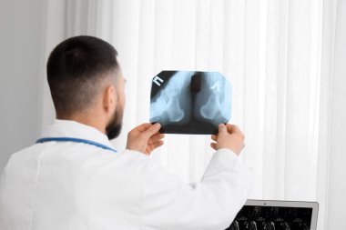 Erkek doktor klinikteki pencerenin yakınındaki ayakların röntgen taraması üzerinde çalışıyor.