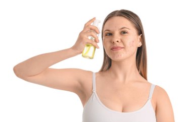 Sivilceli genç bir kız ve beyaz arka planda bir şişe kozmetik ürünü, yakın plan.