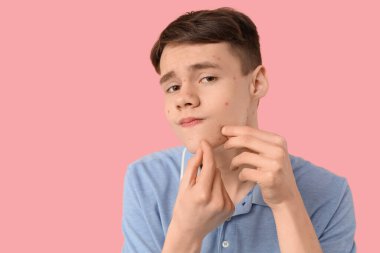 Pembe arka planda sivilceleri olan genç bir çocuk, yakın plan.