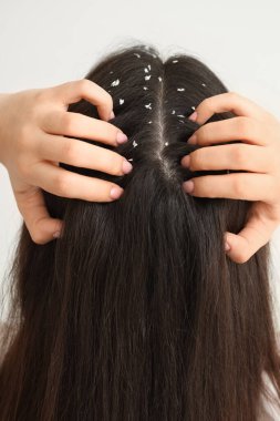 Kepek sorunu olan genç bir kadın. Beyaz arka planda kafasını kaşıyor.