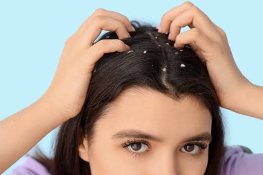 Kepek sorunu olan genç bir kadın mavi arka planda kafasını kaşıyor, yakın plan.