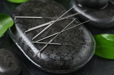 Koyu arkaplanda akupunktur iğneleri ve spa taşları, yakın plan.