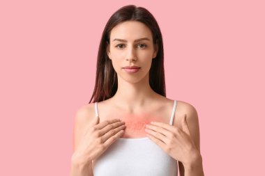 Pembe arka planda kırmızı güneş yanığı olan alerjisi olan genç bir kadın.