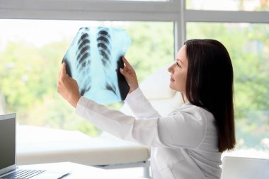 Kadın doktor hastanede akciğerlerin röntgen görüntülerini inceliyor.