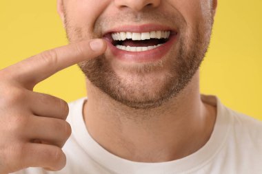 Genç adam sarı arka plandaki gülüşüne işaret ediyor, yakın plan.