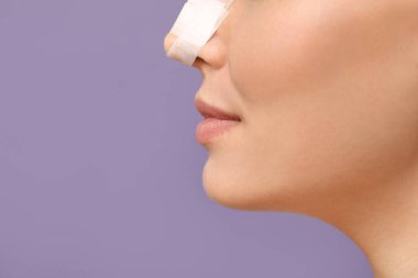 Leylak arka planında sargılı burunlu genç bayan, yakın plan. Estetik ameliyat konsepti