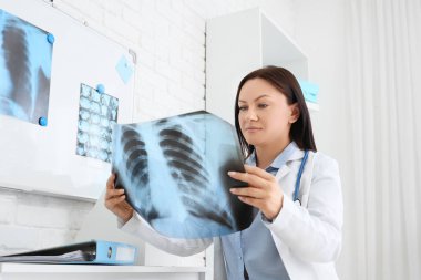 Klinikteki masada akciğerlerinin röntgenini çeken kadın doktor.