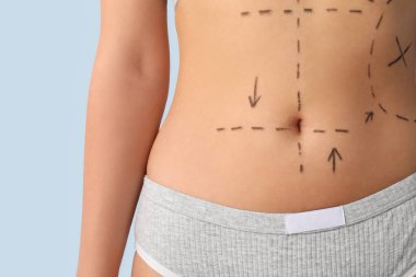 İç çamaşırlı genç bir kadın, göbeğinde hafif arka planda izler var, yakın plan. Estetik ameliyat konsepti