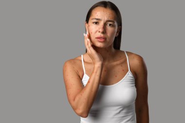 Geçmişinde suçiçeği olan genç bir kadın.