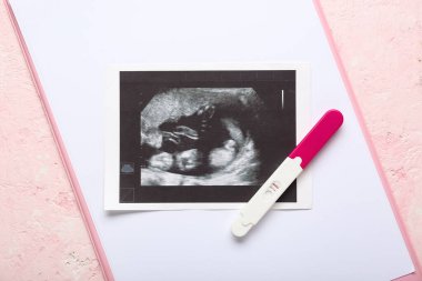 Pembe grunge arka planında sonogram görüntüsü ve hamilelik testi olan bir pano. Tüp bebek konsepti