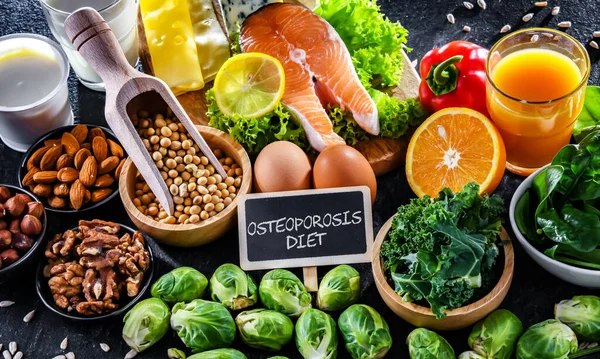 Födoämnen Som Rekommenderas För Osteoporos Och Friska Ben — Stockfoto