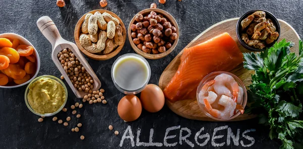 Σύνθεση Κοινά Αλλεργιογόνα Τροφίμων Όπως Αυγό Γάλα Σόγια Ξηρούς Καρπούς — Φωτογραφία Αρχείου