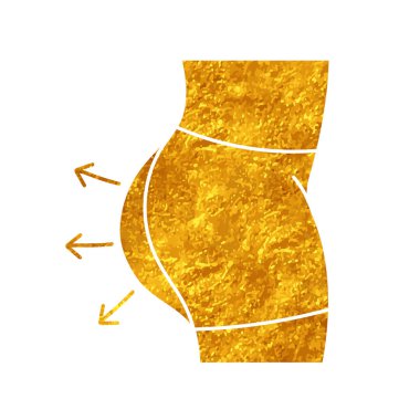 Kadınların güzelliği estetik cerrahi kalça büyütme ile karşılaşıyor.